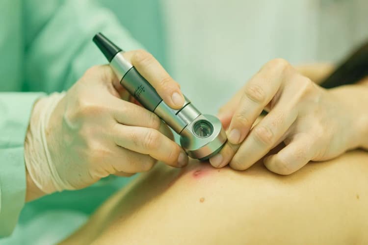 Dermatologista usando um dermatoscópio para examinar uma pinta na pele, plano médio, luz clínica vinda de cima, sem ação.